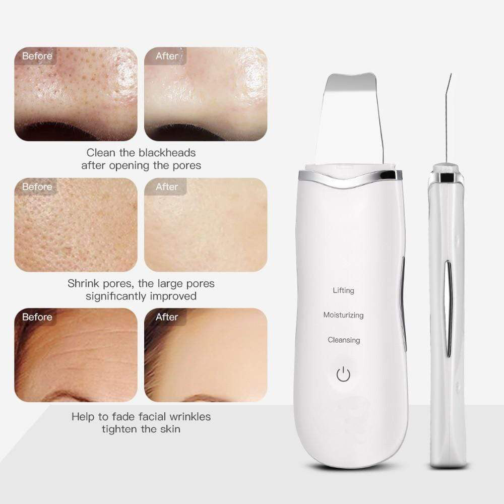 ClearWave™ Ultrasonic Blackhead Remover